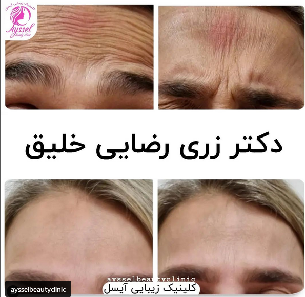 مطب دکتر زری رضایی خلیق لاهیجان