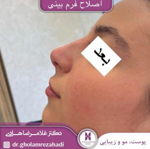 مطب پوست و مو زیبایی اردبیل دکتر غلامرضا هادی اردبیل