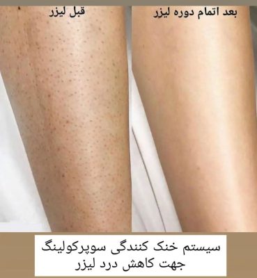 اصلاح فرم بینی بدون جراحی در اردبیل دکتر غلامرضا هادی