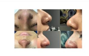 ارسال آگهی 16 ارسال آگهی