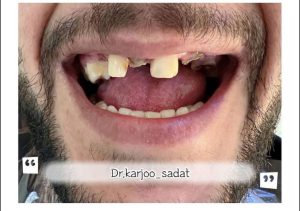 بهترین دندانپزشکی گلابدره تجریش دربند نیاوران