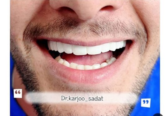 بهترین دندانپزشکی گلابدره تجریش دربند نیاوران